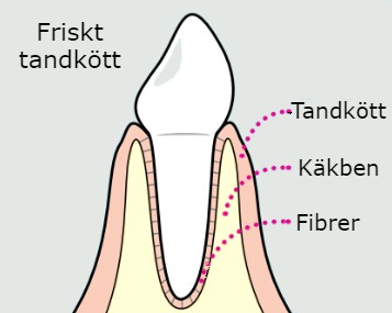 Bild på ett friskt tandkött